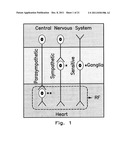 Apparatus and Methods for Arrhythmia Treatment Based on Spectral Mapping     During Sinus Rhythm diagram and image