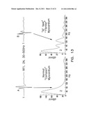 Apparatus and Methods for Arrhythmia Treatment Based on Spectral Mapping     During Sinus Rhythm diagram and image