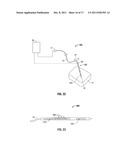 Specific Absorption Rate Measurement and Energy-Delivery Device     Characterization Using Image Analysis diagram and image