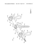 SPINAL STABILIZATION SYSTEM diagram and image