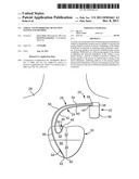 Atrial Tachyarrhymia Detection System And Method diagram and image