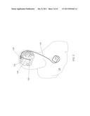 MICROFABRICATED NEUROSTIMULATION DEVICE diagram and image