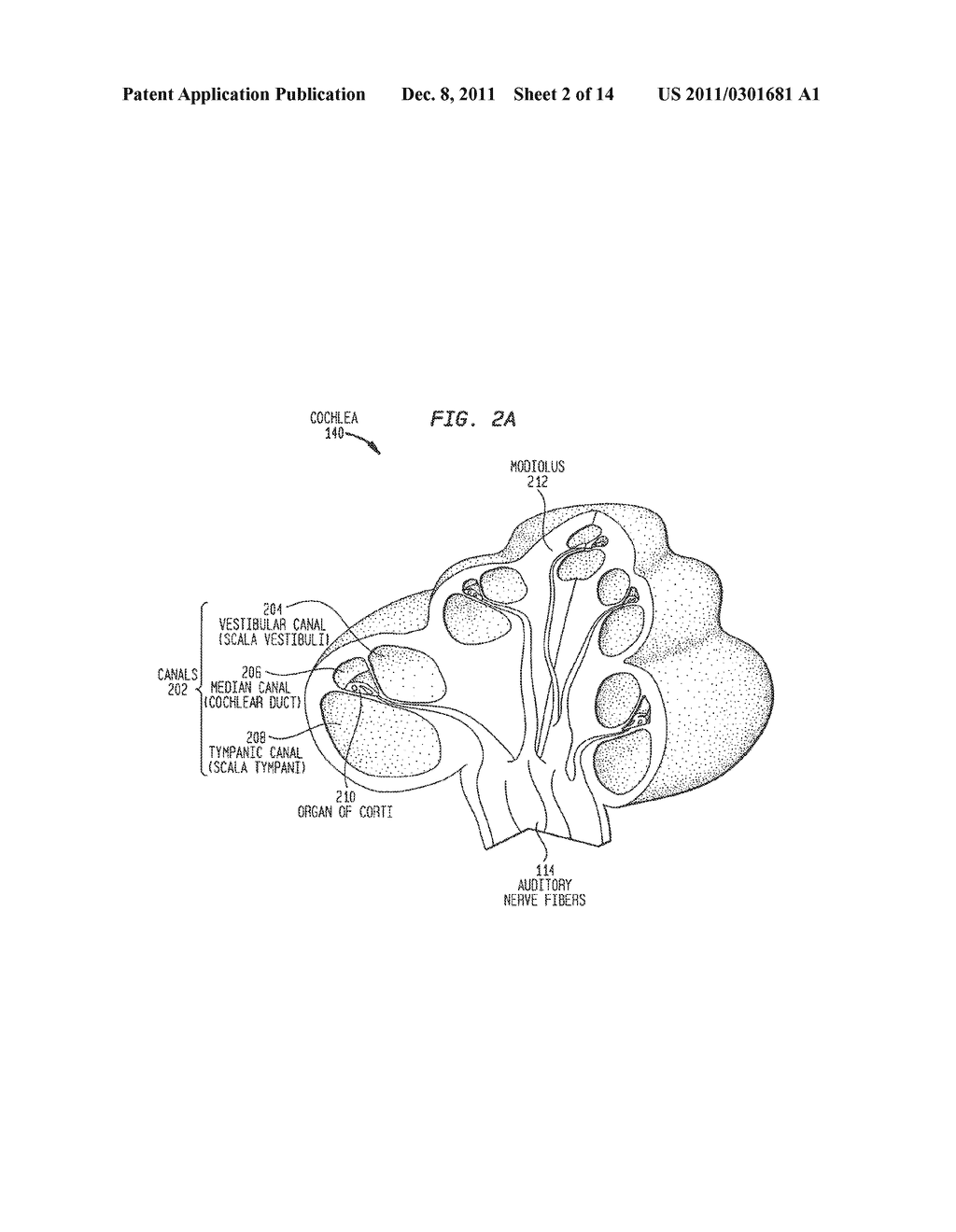 ELECTRODE ASSEMBLY FOR A STIMULATING MEDICAL DEVICE - diagram, schematic, and image 03