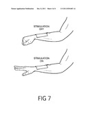 CUSTOMIZABLE MEDICAL ELECTRODE diagram and image