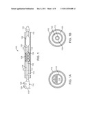 Prosthetic Valve Delivery System diagram and image