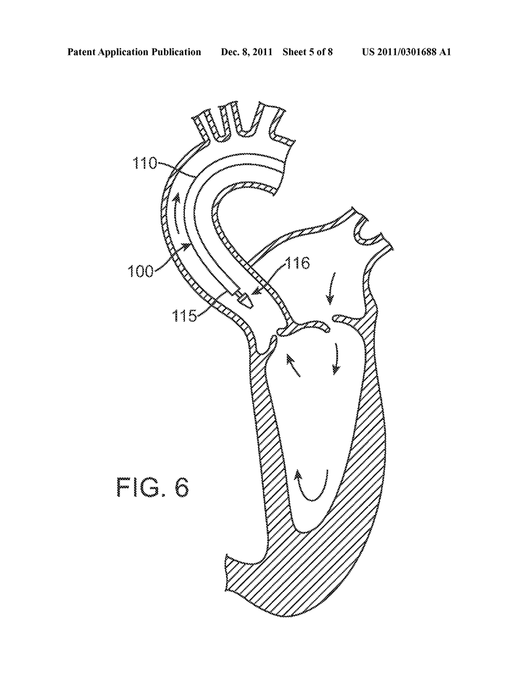 Prosthetic Valve Delivery System - diagram, schematic, and image 06