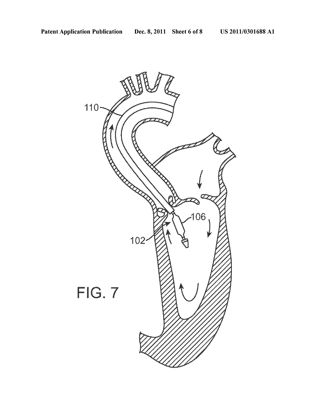 Prosthetic Valve Delivery System - diagram, schematic, and image 07