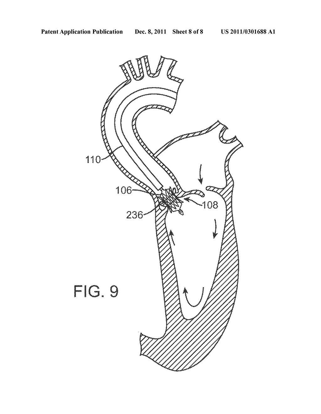 Prosthetic Valve Delivery System - diagram, schematic, and image 09