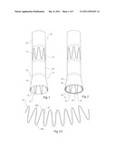 ILIAC EXTENSION WITH FLARED CUFF diagram and image