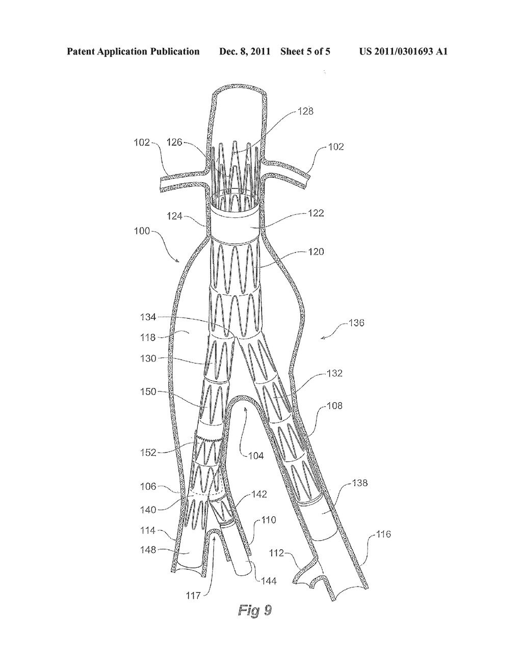 ILIAC EXTENSION WITH FLARED CUFF - diagram, schematic, and image 06