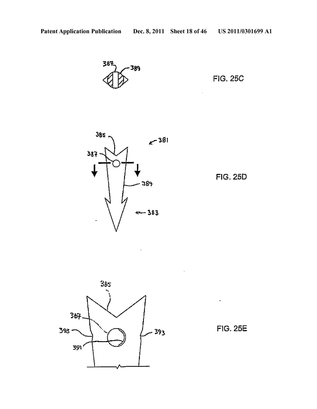 APPARATUS AND METHODS FOR TREATING TISSUE - diagram, schematic, and image 19