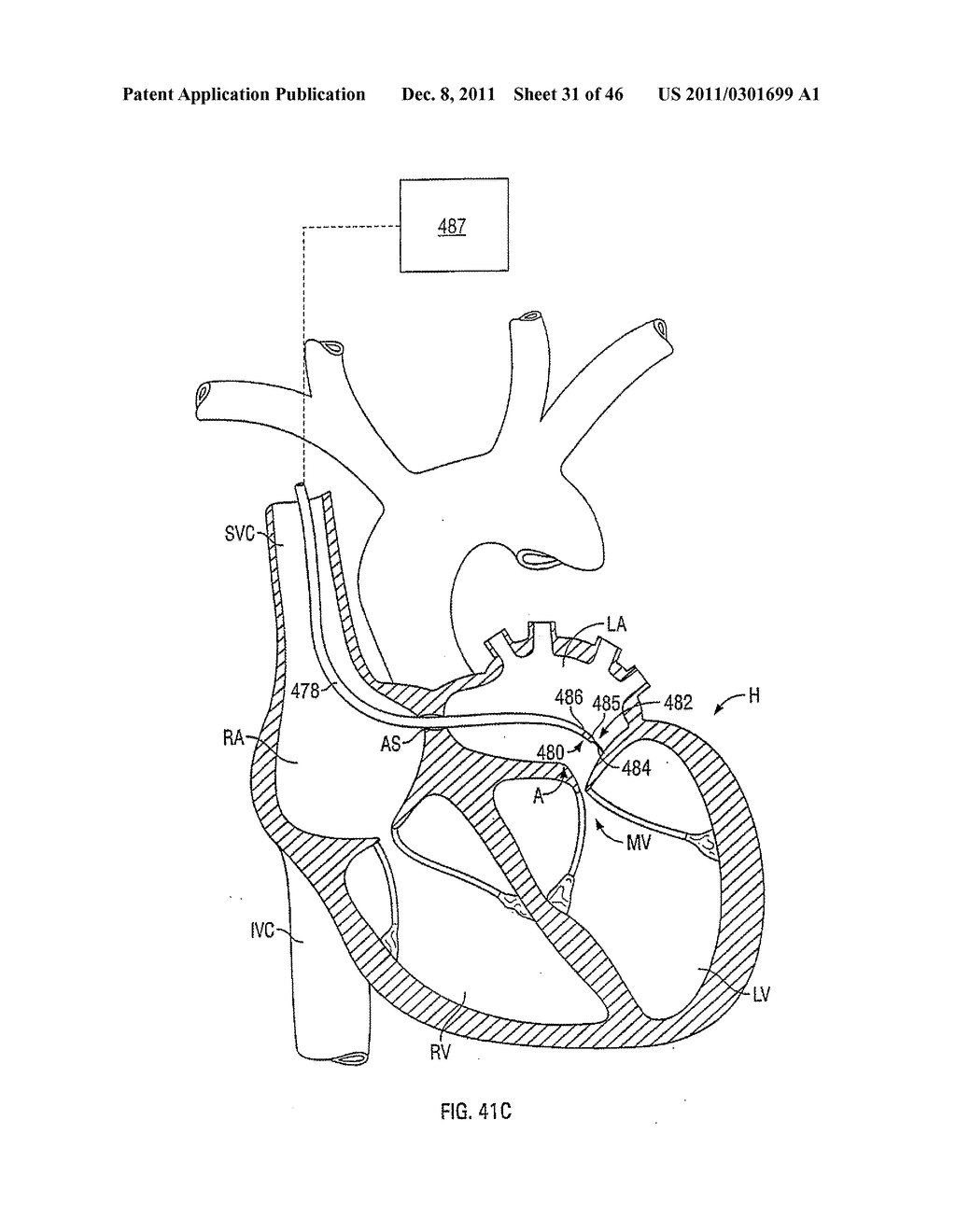 APPARATUS AND METHODS FOR TREATING TISSUE - diagram, schematic, and image 32