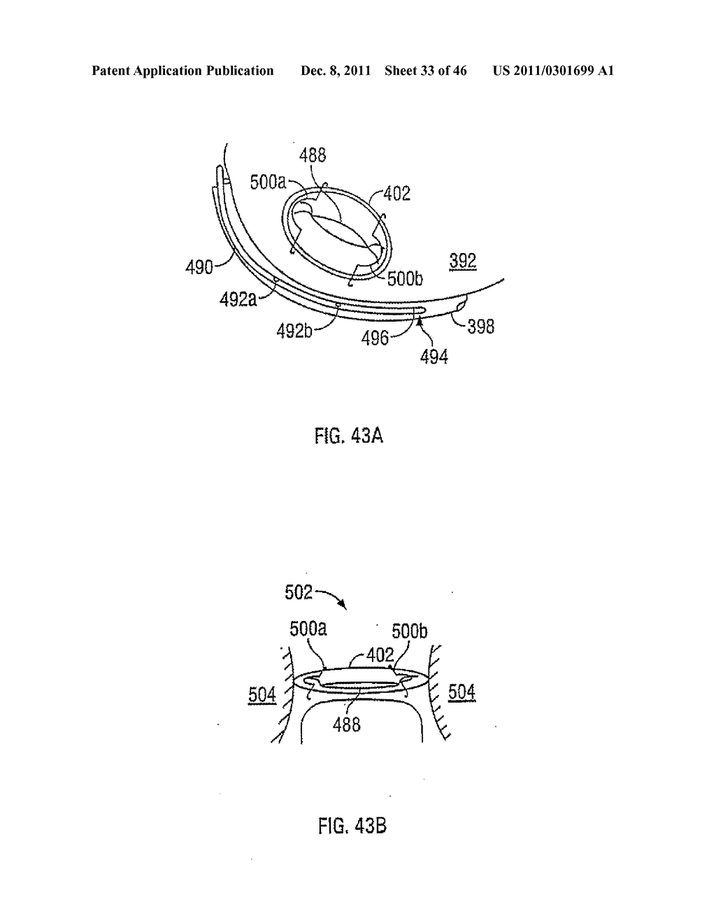 APPARATUS AND METHODS FOR TREATING TISSUE - diagram, schematic, and image 34