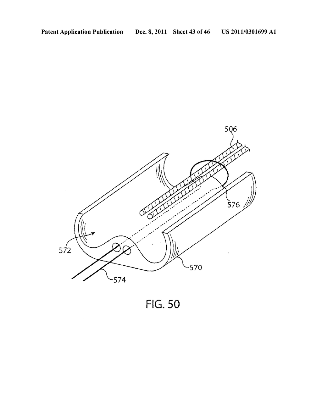 APPARATUS AND METHODS FOR TREATING TISSUE - diagram, schematic, and image 44