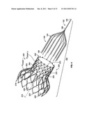 DEVICES AND METHODS FOR COLLAPSING PROSTHETIC HEART VALVES diagram and image