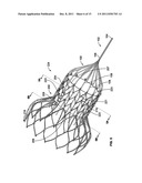 DEVICES AND METHODS FOR COLLAPSING PROSTHETIC HEART VALVES diagram and image