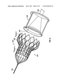 DEVICES AND METHODS FOR COLLAPSING PROSTHETIC HEART VALVES diagram and image