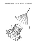 DEVICES AND METHODS FOR COLLAPSING PROSTHETIC HEART VALVES diagram and image