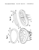 Annuloplasty Rings for Repair of Abnormal Mitral Valves diagram and image