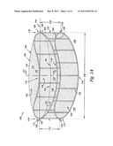 Cardiac Valve, System, and Method diagram and image