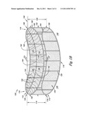 Cardiac Valve, System, and Method diagram and image