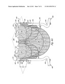 Cardiac Valve, System, and Method diagram and image