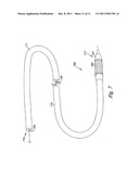 Cardiac Valve, System, and Method diagram and image