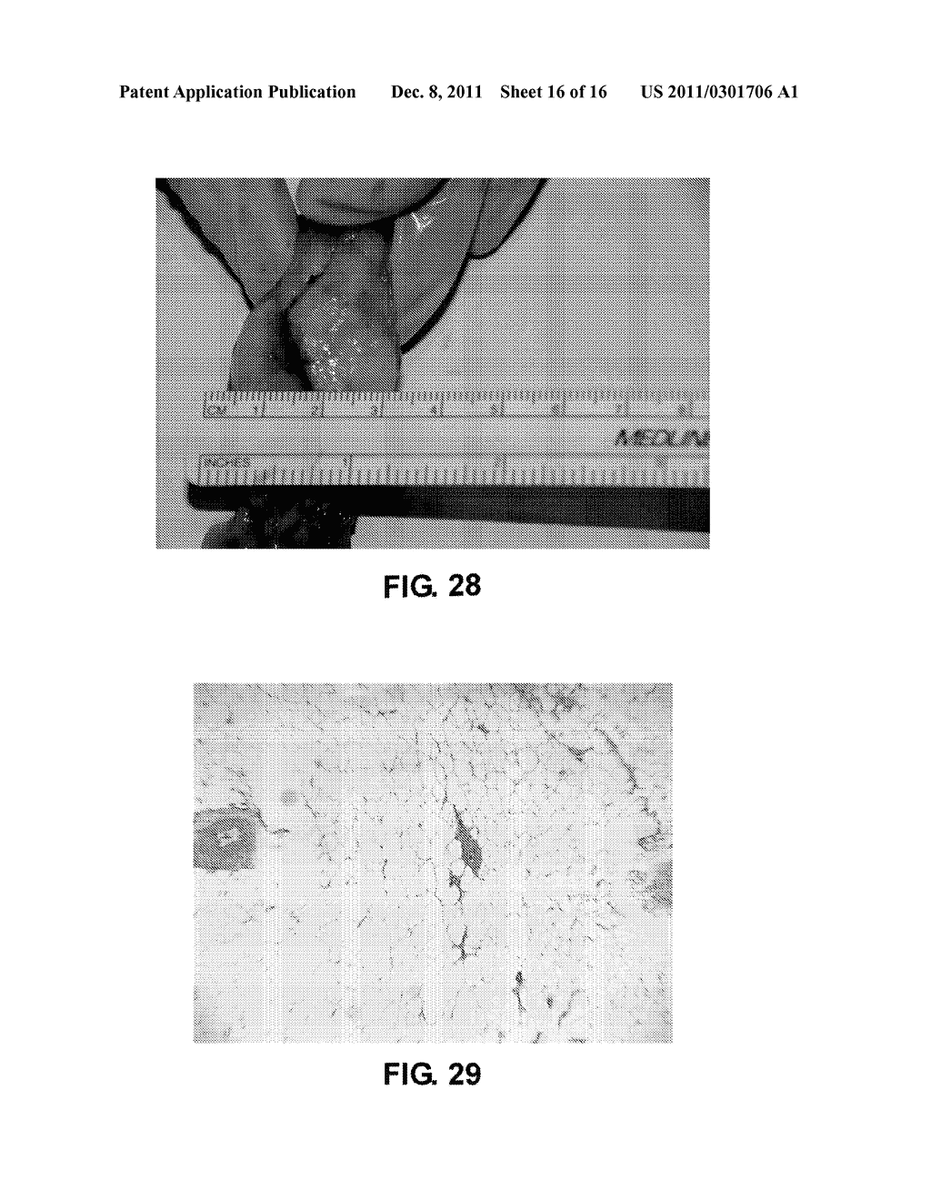 Breast Reconstruction Device And Methods - diagram, schematic, and image 17