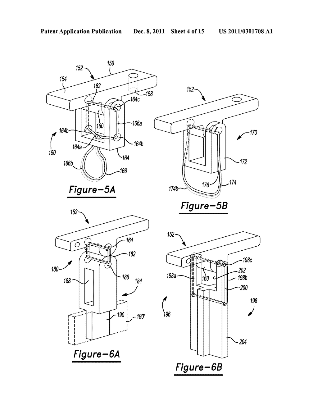 Method and Apparatus for Soft Tissue Fixation - diagram, schematic, and image 05