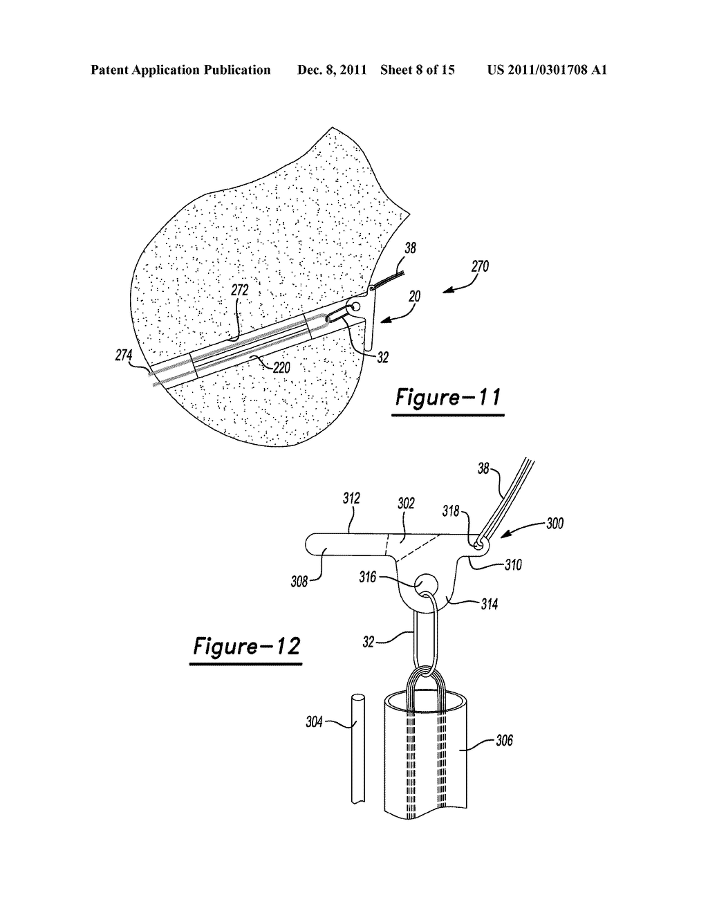 Method and Apparatus for Soft Tissue Fixation - diagram, schematic, and image 09