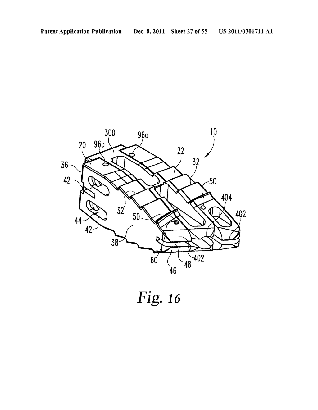 SYSTEM AND METHODS FOR A LATERALLY EXPANDING IMPLANT - diagram, schematic, and image 28