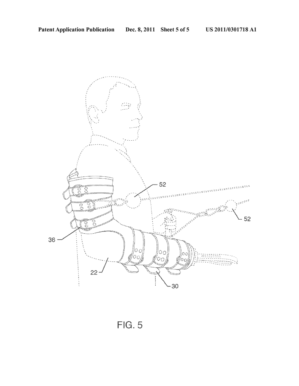 EXERCISE DEVICE FOR USE WITH A PROSTHESIS - diagram, schematic, and image 06