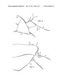 NECKTIE KNOT STAY diagram and image