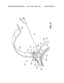 PROTECTION SYSTEM FOR STRUCTURAL MEMBERS SUCH AS CABLES diagram and image