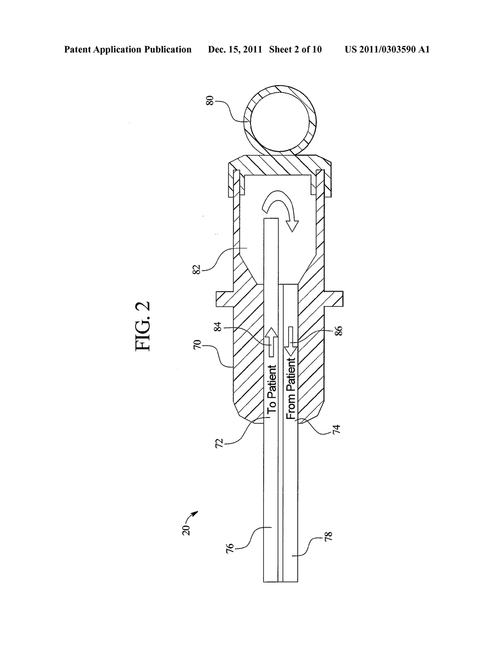 WEIGHT/SENSOR-CONTROLLED SORBENT SYSTEM FOR HEMODIALYSIS - diagram, schematic, and image 03