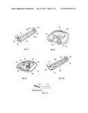 Sink rack and system for supporting large frying pans horizontally within     the confines of a kitchen sink diagram and image