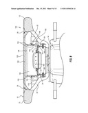 INFLATABLE AIRBAG ASSEMBLY HAVING A COSMETIC COVER WITH A FLEXIBLE     MOUNTING BRACKET diagram and image