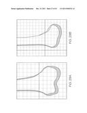 INTELLIGENT CARTILAGE SYSTEM diagram and image