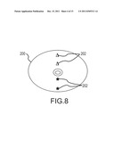 FIDUCIAL SYSTEMS FOR MAMMOGRAPHY diagram and image