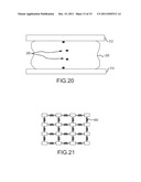 FIDUCIAL SYSTEMS FOR MAMMOGRAPHY diagram and image