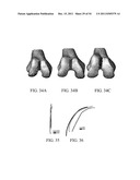 DEFORMABLE ARTICULATING TEMPLATE (formerly: CUSTOMIZED ORTHOPAEDIC     IMPLANTS & RELATED METHODS) diagram and image