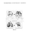 DEFORMABLE ARTICULATING TEMPLATE (formerly: CUSTOMIZED ORTHOPAEDIC     IMPLANTS & RELATED METHODS) diagram and image
