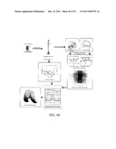 DEFORMABLE ARTICULATING TEMPLATE (formerly: CUSTOMIZED ORTHOPAEDIC     IMPLANTS & RELATED METHODS) diagram and image