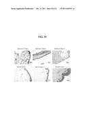 COMPOSITIONS AND METHODS FOR TREATING CANCER diagram and image