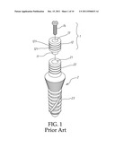 ABUTMENT EXTENDER FOR ONE PIECE IMPLANT diagram and image