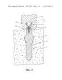ABUTMENT EXTENDER FOR ONE PIECE IMPLANT diagram and image
