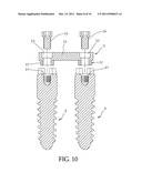 ABUTMENT EXTENDER FOR ONE PIECE IMPLANT diagram and image