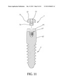 ABUTMENT EXTENDER FOR ONE PIECE IMPLANT diagram and image