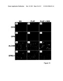 RETENTION OF A STEM CELL PHENOTYPE diagram and image