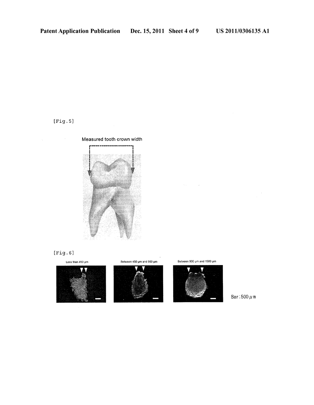 METHOD FOR PRODUCING TOOTH - diagram, schematic, and image 05